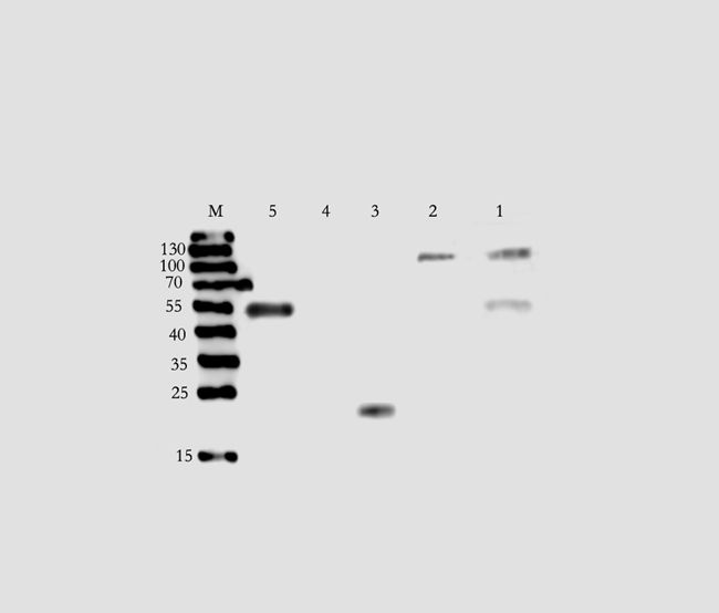 KREM1 Rabbit Polyclonal Antibody