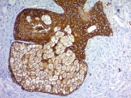 KRT77 Antibody