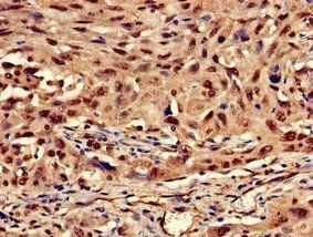 KRT13 Antibody