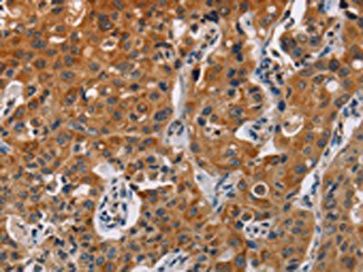 KRT13 Antibody