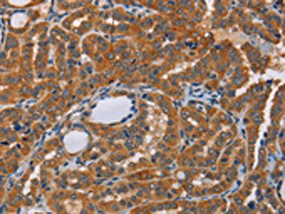 KRT13 Antibody