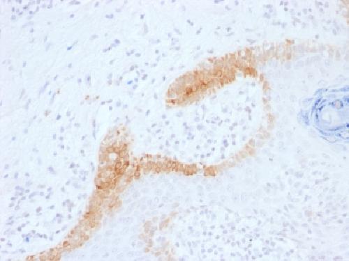 KRT15 Antibody