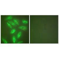 KRT18 Antibody