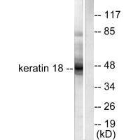 KRT18 Antibody