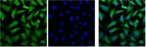 KRT18 Antibody