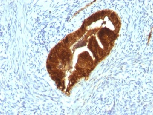 KRT19 Antibody