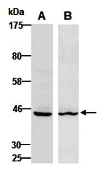 KRT19 (vPairTM) Antibodies