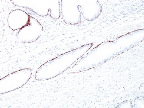 KRT76 Antibody