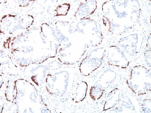KRT76 Antibody