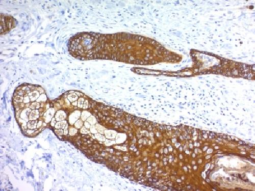 KRT76 Antibody