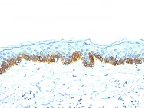 KRT77 Antibody