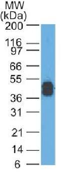 KRT77 Antibody