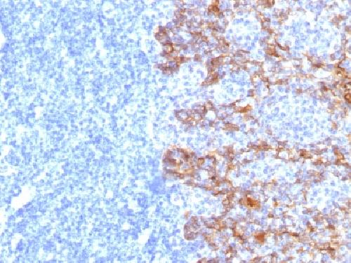 KRT77 Antibody