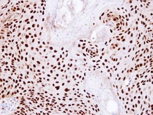 Ku80 Rabbit Polyclonal Antibody