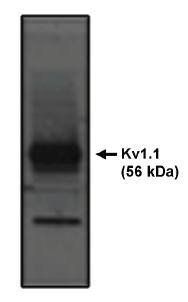 Rabbit Rat Kv1.1 Potassium Channel Antibody