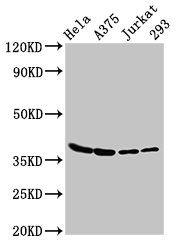 LDHA Antibody