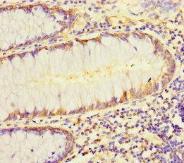 L1TD1 Antibody