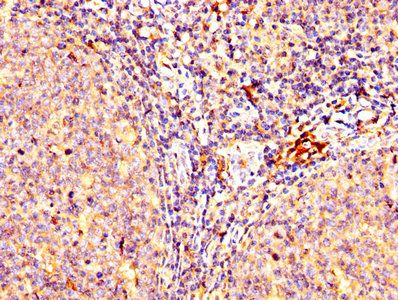 LAG3 Antibody