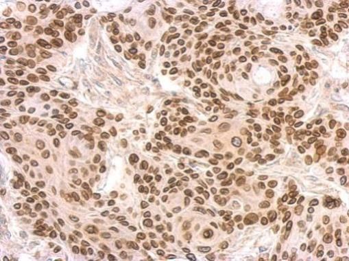 lamin B2 Antibody
