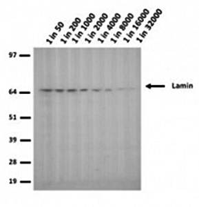 Lamin A+C mutant R453W Monoclonal Antibody