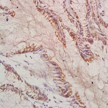 LAMA3 Rabbit Polyclonal Antibody