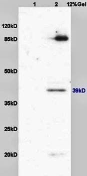 Laminin Beta 1 Rabbit pAb