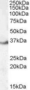 LASP1 (internal region) Antibody
