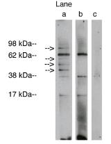 Rabbit anti Human Lass1 (Crossreacts with GDF1) Antibody