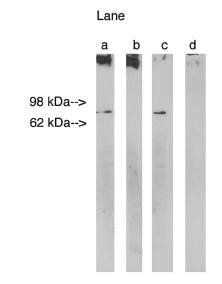 Rabbit anti Human Lass1 (non-GDF1) Antibody