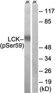 LCK (Phospho-Ser59) Antibody