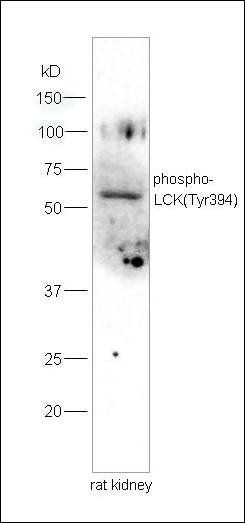 Phospho-LCK (Tyr394) Rabbit Polyclonal Antibody