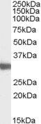 LDHC (aa 217 - 231) Antibody