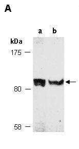 LEMD3 (N) Antibody, Rabbit Polyclonal