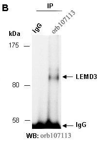 LEMD3 (N) Antibody, Rabbit Polyclonal