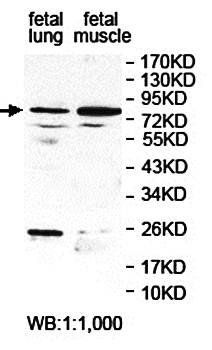 LEPREL2 Rabbit Polyclonal Antibody
