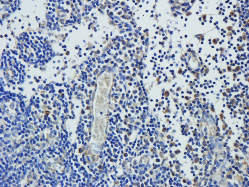 Leptin Receptor antibody