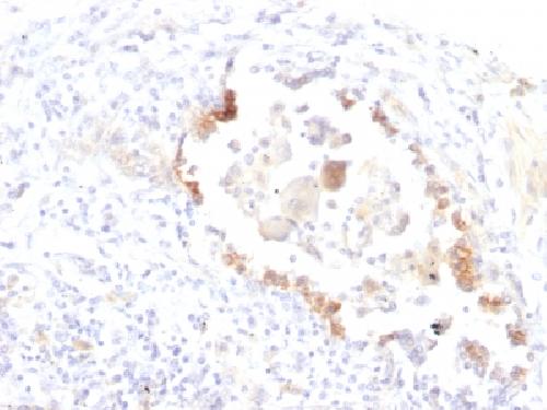 Lewis Y (Tumor Marker) Antibody