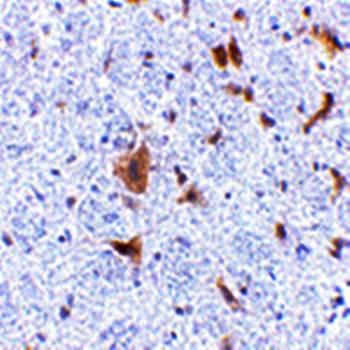 LFG Rabbit Polyclonal Antibody