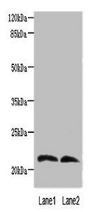 LGALS9C Antibody