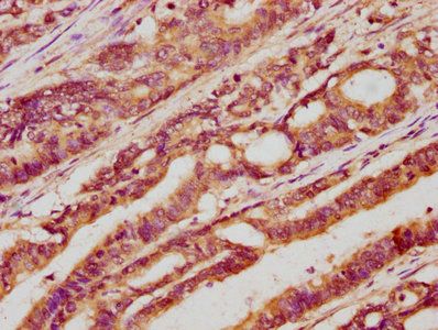 LGR5 Antibody