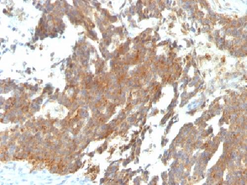 GNRHR Antibody