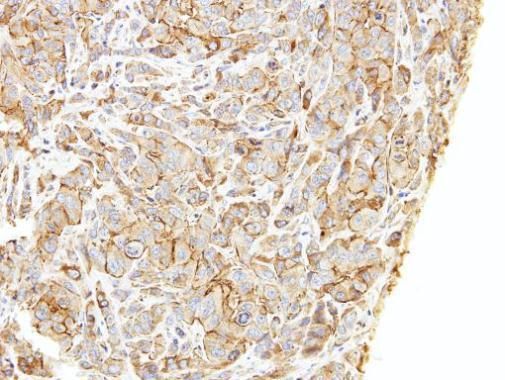 LIM and calponin homology domains 1 Antibody
