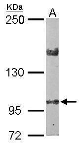 LIM and calponin homology domains 1 Antibody