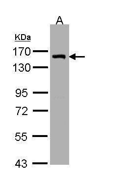 LIM and calponin homology domains 1 Antibody