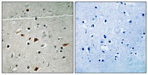 LIMK2 (Phospho-Ser283) Antibody