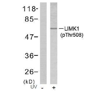 LIMK2 (Phospho-Thr505) Antibody
