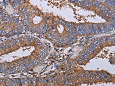 LIMS1 Antibody