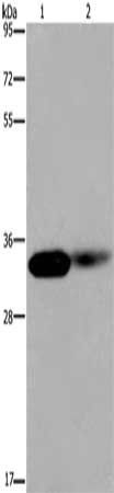 LIMS1 Antibody
