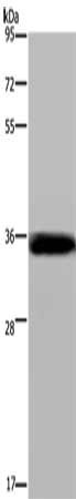 LIMS1 Antibody