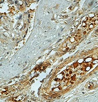 LIN28 Rabbit Polyclonal Antibody